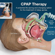 Illustration for article titled CPAP Advice?